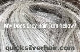 Consultant trichologist anabel kingsley explains the causes behind your graying hair, what solutions she recommends for covering them up — should you choose — and how to best care for gray hair. Pin On Hair Ideas