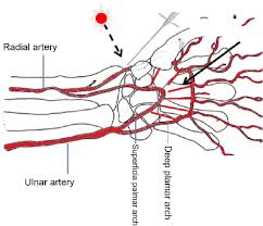 Puncture Needle In The Anatomical Snuffbox Dotted Arrow Straight Download Scientific Diagram The anatomical snuff box is actually a small depression on the back of the hand where the thumb joins the wrist, caused by the radial tendons. puncture needle in the anatomical