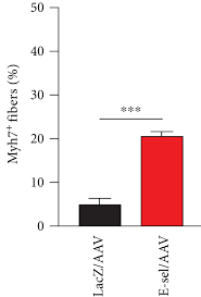 Image result for Black 1998 AAV