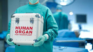 Image result for Transplantation