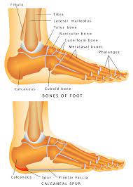 Find Out Common Misconceptions About Heel Spur Pain