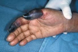 images?q=tbn:ANd9GcQ723VMPL4J8AS6iu9NXqFY4w3DiyXCMDaegg&usqp=CAU