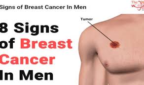 Differential diagnosis for male breast cancer. Breast Cancer In Men Posts Breaking News Current News World News The Wau