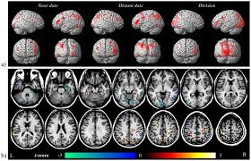 Related online courses on physioplus. Asperger S Syndrome News Research Tags Articles Neuroscience News
