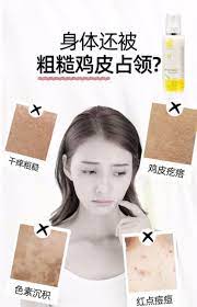 身体还被粗糙鸡皮占领 干痒粗糙 鸡皮疙瘩 色素沉淀 红点痘痘 charmzchamomile 改善 鸡皮肤 贵在坚持 无论晴天雨天 洗澡用 charmzchamomile 滋养皮肤 不做 懒女人 皮肤才会变得更美 鸡