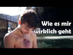 Philipp mickenbecker hat sich schon immer gewehrt: Youtube Star Philipp Mickenbecker Der Tumor Ist Ziemlich Gewachsen