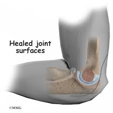 Patient Education Concord Orthopaedics