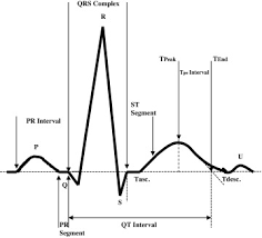 Ecg Based Heartbeat Classification For Arrhythmia Detection