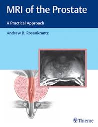 Mri Of The Prostate Ebook Mri Prostate Radiology Imaging