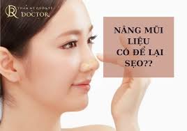 NÂNG MŨI CÓ ĐỂ LẠI SẸO KHÔNG?