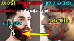 How To Grow Full Beard Malayalam How To Grow Beard Fast And Thick How To Treat Patchy Bread Youtube