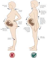 Backache And Pain In Pregnancy Hse Ie