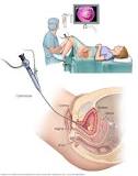 Image result for what are the types of treatment available for bladder cancer?