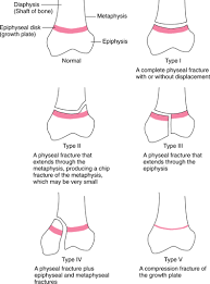 Pin By Rubee Lynn Quiwa On Peds Radiology Medical Knowledge Medical Anatomy
