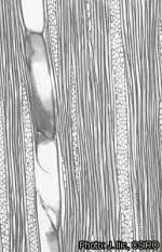 Image result for Annickia