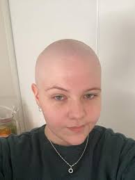 Menopause at 18: SA woman's struggle to beat Hodgkin's lymphoma