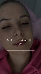 Modelowanie ust kwasem hialuronowym. , Moim priorytetem jest zawsze  podkreślenie naturalnego kształtu i ujędrnienie ust, ale nie przerysowanie.  ❤️ , modelowanie ust• powiększanie ust• medycyna ...