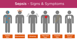 The easiest way to remember the symptoms of sepsis is to associate. Steeper Group Sepsis The Signs And Symptoms