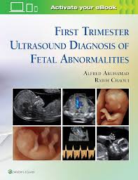 Image result for First Trimester Ultrasound