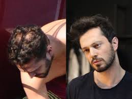 Murat Boz Neo Hair