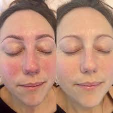 Profile for Visage House Beauty Clinic