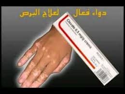 علاج البرص طريقة لعلاج مرض البرص دلع ورد