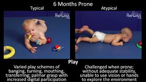 6 month old baby typical atypical development side by side