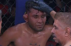 Watch Ultimate Warrior Challenge fighter lose after ear explodes during MMA  title bout in Mexico