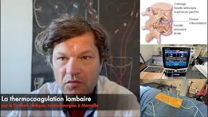 Traitement de l'extension des articulations facettaires lombaires/ mentorat  Accès Physio