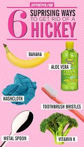 6 Surprising Ways To Get Rid Of A Hickey | How To Hide Hickeys, Hickeys, Get  Rid Of Hickies