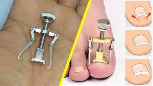 ‪اذاة لتقويم اعوجاج اظافر القدم - Ingrown Toe Nail Fixer Correction Tool  Fixer Recover Toe Paronychia‬‏