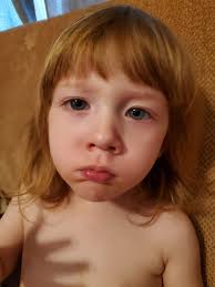 Hi my son is 12 he's autism and afrid, he was diagnosed with a post natural  drip ( the tube you have in your nose to your throat is too narrow) so