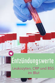 Entzundungswerte Im Blut Das Sollten Sie Daruber Wissen Mit Bildern Entzundungen Im Korper