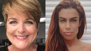 Veja abaixo os resultados dos tratamentos dentários antes e depois realizados pela equipa de dentistas da clínica mint lisboa. Luisa Castel Branco Acusada De Faltar Ao Respeito A Carlos Costa