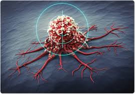 What Is Von Hippel Lindau Syndrome