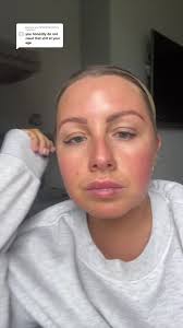 Replying to @user5049103573273 4 week botox update. Thats me hooked now int  it. I went to foxie aesthetics