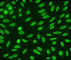 Image result for ANA Staining Pattern