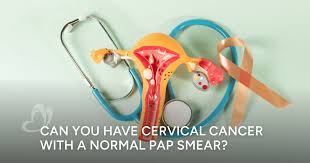 Image result for Pap Smear