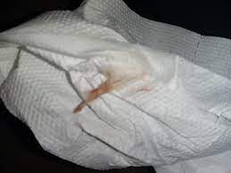 Selama kehamilan, leher rahim ditutupi oleh lendir yang kental. Apa Ini Tanda Kehamilan Ibuhamil Com