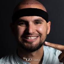 Estetik ve Diş Tedavileri Türkiye