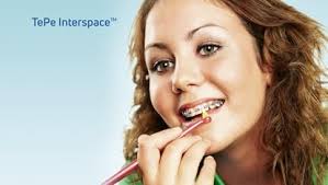 Amazon.com : Fremouth End Tuft Orthodontic Toothbrush for Braces, Soft  Bristles, 6 Count : Health & Household