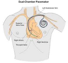 Pin On Cardiac Notes