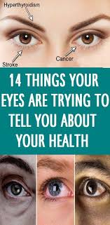 14 Things Your Eyes Are Trying To Tell You About Your Health Eye Health Computer Vision Syndrome Health