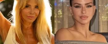 Se quebró la muñeca jugando al fútbol y la DGE deberá indemnizarlo