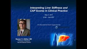 2017 05 03 12 00 Interpreting Liver Stiffness And Cap Scores In Clinical Practice