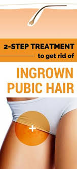 Even though the formation of an ingrown hair can be cured by not waxing, shaving or plucking the hair, these cleaning the pubic area might be useful before shaving can be highly useful. Pubic Hair Removal