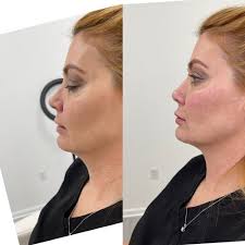 BEST of Owensboro Facial