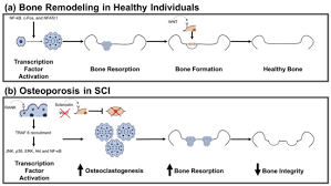 Invoking a save() method on a model will asynchronously. Ijms Free Full Text The Pathophysiology Of Osteoporosis After Spinal Cord Injury