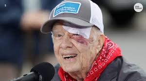 Jimmy carter was the 39th president of the united states with accomplishments that go beyond the presidency.carter is known for his humanitarian work. Former President Jimmy Carter Released From Hospital After Fall