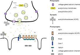 Congenital Myasthenic Syndrome A Brief Review Pediatric Neurology